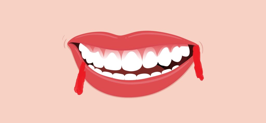 تعرف على أسباب خروج الدم من الفم