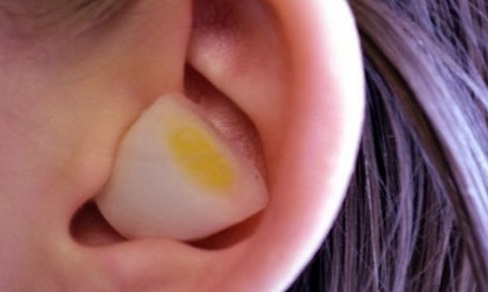 طريقة علاج إنسداد الأذن في المنزل