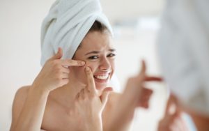 علاج حب الشباب