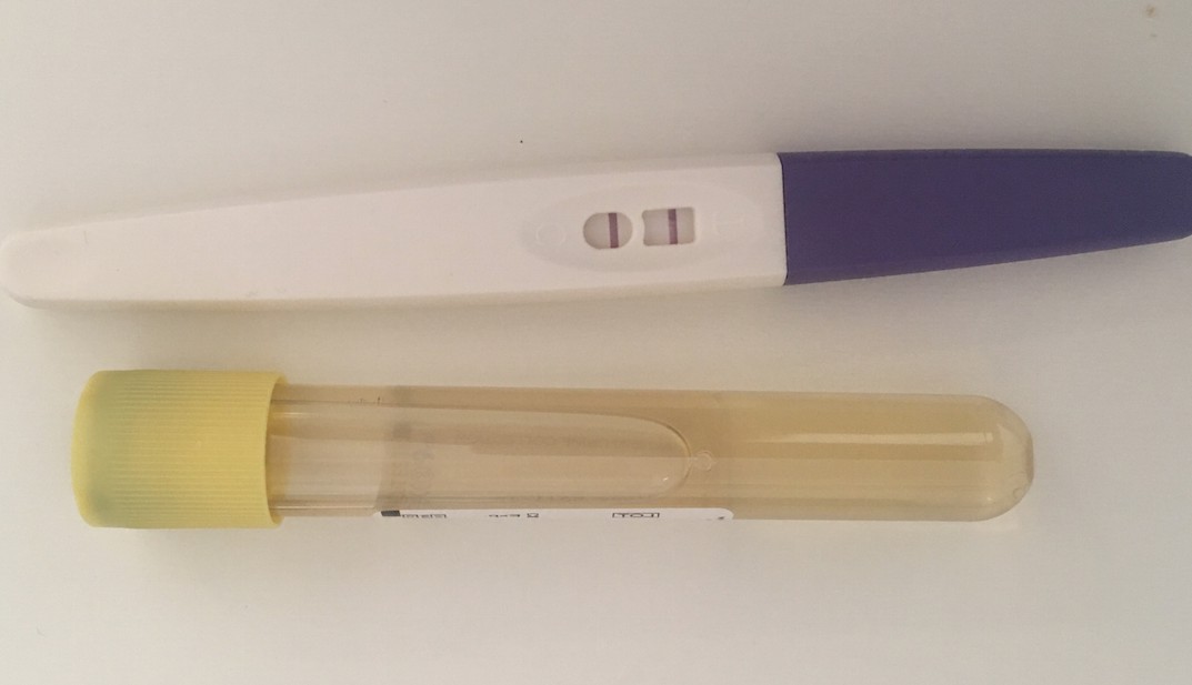 اختبار الحمل وطريقة استخدامة