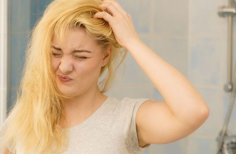 كيفية علاج قشرة الشعر