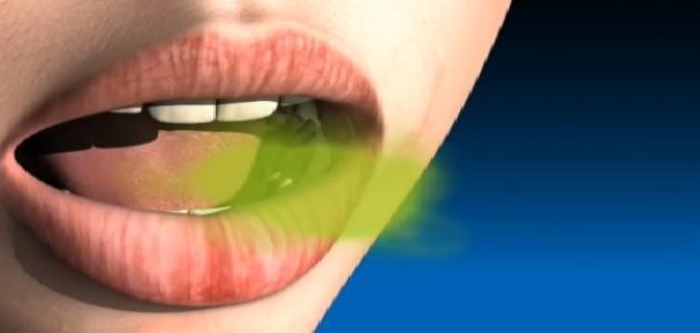علاج رائحة الفم الكريهة نهائيا