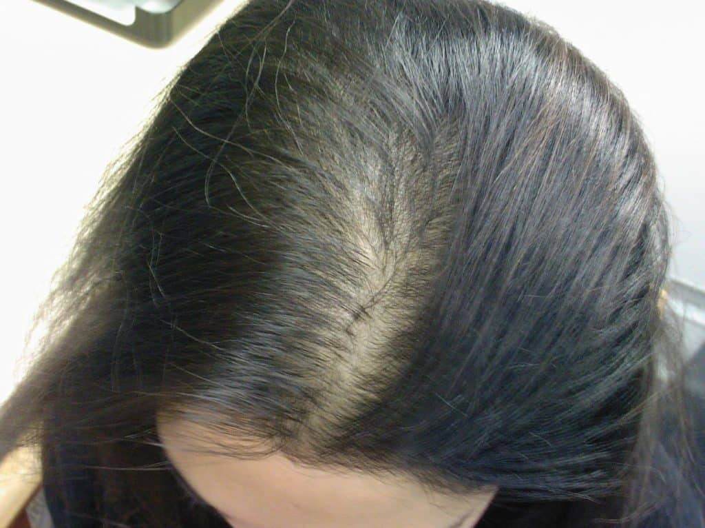 طريقة علاج الشعر الضعيف والخفيف