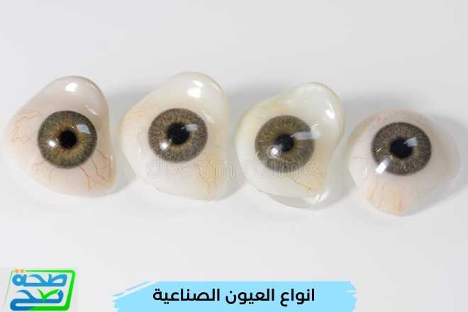 انواع العيون الصناعية