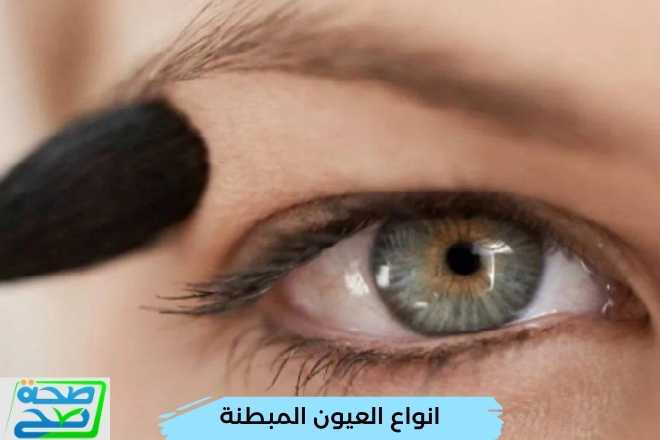 انواع العيون المبطنة