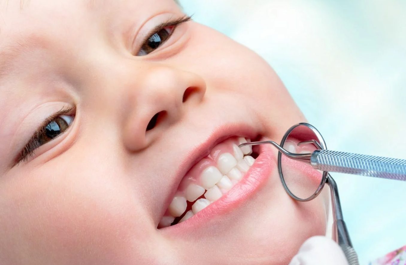 infant dental insurance